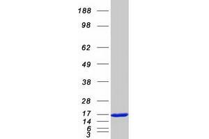 Validation with Western Blot (FABP2 Protein (Myc-DYKDDDDK Tag))