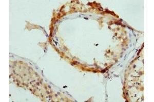 Immunohistochemistry (IHC) image for anti-Adaptor-Related Protein Complex 2, alpha 2 Subunit (AP2A2) (AA 590-939) antibody (ABIN7144362)