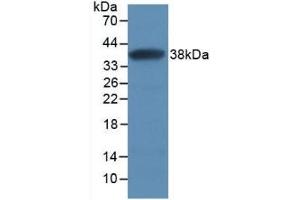 Detection of Recombinant SFRP1, Human using Monoclonal Antibody to Secreted Frizzled Related Protein 1 (SFRP1) (SFRP1 Antikörper  (AA 32-314))