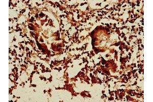 Immunohistochemistry of paraffin-embedded human appendix tissue using ABIN7150819 at dilution of 1:100 (DCTN5 Antikörper  (AA 1-182))
