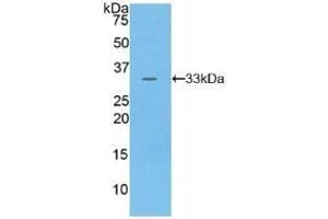 Detection of Recombinant PKN1, Human using Polyclonal Antibody to Protein Kinase N1 (PKN1) (PKN1 Antikörper  (AA 615-874))