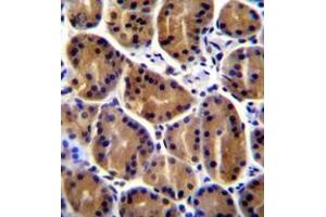 Immunohistochemistry analysis in formalin fixed and paraffin embedded human stomach tissue reacte with Plakophilin-2 Antibody (C-term) followed whcih was peroxidase conjugated to the secondary antibody and followed by DAB staining. (Plakophilin 2 Antikörper  (C-Term))
