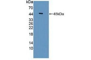 Detection of Recombinant ISLR, Human using Polyclonal Antibody to Immunoglobulin Superfamily Containing Leucine Rich Repeat Protein (ISLR) (ISLR Antikörper  (AA 19-428))