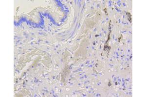 Immunohistochemistry of paraffin-embedded human lung using BAK1 antibody (ABIN4903006) at dilution of 1:100 (40x lens).