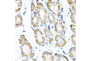 Immunohistochemistry of paraffin-embedded human stomach using ST6GAL1 antibody (ABIN5973377) at dilution of 1/100 (40x lens). (ST6GAL1 Antikörper)