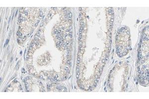 ABIN6267562 at 1/100 staining Human prostate tissue by IHC-P. (Calmodulin 1 Antikörper  (pSer81, pThr79))