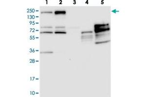 Western blot analysis of Lane 1: RT-4, Lane 2: U-251 MG, Lane 3: Human Plasma, Lane 4: Liver, Lane 5: Tonsil with PDS5B polyclonal antibody  at 1:250-1:500 dilution. (PDS5B Antikörper)
