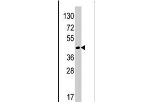 Western blot analysis of RAD9A polyclonal antibody  in HeLa cell line lysates (35 ug/lane). (RAD9A Antikörper  (Internal Region))
