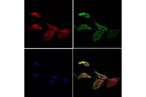 ABIN7094098 and ABIN7098142 staining Hela cells by IF/ICC. (C14orf102 Antikörper  (Internal Region))