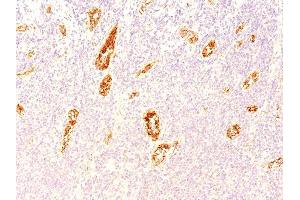 Formalin-fixed, paraffin-embedded human Pancreas stained with vWF Mouse Monoclonal Antibody (3E2D10). (VWF Antikörper  (AA 845-949))
