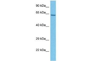 Host:  Rabbit  Target Name:  MBOAT1  Sample Tissue:  Human U937 Whole Cell  Antibody Dilution:  1ug/ml (MBOAT1 Antikörper  (N-Term))