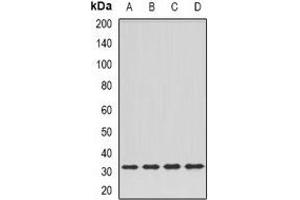 Western blot analysis of DPM1 expression in Hela (A), SKOV3 (B), mouse kidney (C), rat liver (D) whole cell lysates. (DPM1 Antikörper)