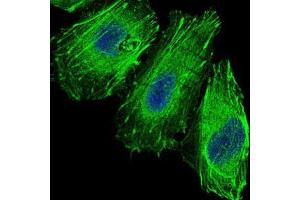 Immunofluorescence analysis of Hela cells using FOXO1 mouse mAb (green).