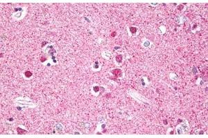 Anti-RPS6KA5 / MSK1 antibody IHC staining of human brain, cortex neurons. (MSK1 Antikörper  (AA 551-600))