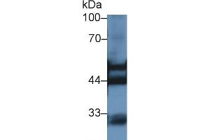 Western blot analysis of Rat Kidney lysate, using Rat KRT7 Antibody (1 µg/ml) and HRP-conjugated Goat Anti-Rabbit antibody ( (Cytokeratin 7 Antikörper  (AA 255-393))