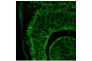 Itgb1 antibody used at a dilution of 1:500 to detect human eye (day 24). (ITGB1 Antikörper  (C-Term))