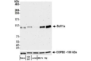 Western Blotting (WB) image for anti-B-Cell CLL/lymphoma 11A (Zinc Finger Protein) (BCL11A) (AA 785-835) antibody (ABIN7452847)