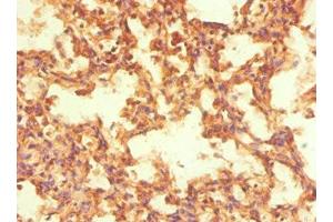 Immunohistochemistry of paraffin-embedded human lung tissue using ABIN7161902 at dilution of 1:100 (NR2C1 Antikörper  (AA 1-240))