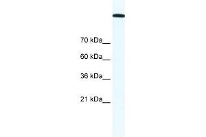 WB Suggested Anti-TOP2A Antibody Titration:  1. (Topoisomerase II alpha Antikörper  (C-Term))