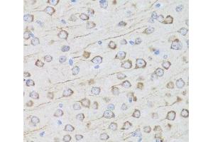 Immunohistochemistry of paraffin-embedded Mouse brain using MIP Polyclonal Antibody at dilution of 1:100 (40x lens). (Mip Antikörper)