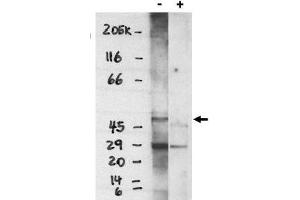 Image no. 1 for anti-Sphingosine-1-Phosphate Receptor 4 (S1PR4) (C-Term) antibody (ABIN265012) (S1PR4 Antikörper  (C-Term))