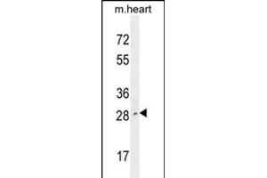 LIX1 Antibody (C-term) (ABIN654749 and ABIN2844431) western blot analysis in mouse heart tissue lysates (35 μg/lane). (LIX1 Antikörper  (C-Term))