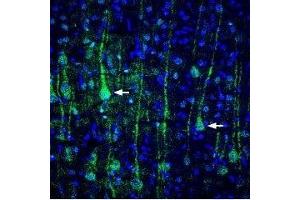 Expression of VGLUT1 in rat cortexImmunohistochemical staining of perfusion-fixed rat brain frozen sections using Anti-VGLUT1 Antibody (ABIN7043684, ABIN7044368 and ABIN7044369), (1:400), followed by goat-anti-rabbit-Alexa-488.