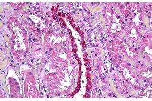 Human Kidney, Renal Duct: Formalin-Fixed, Paraffin-Embedded (FFPE) (TGFBI Antikörper  (AA 119-131))