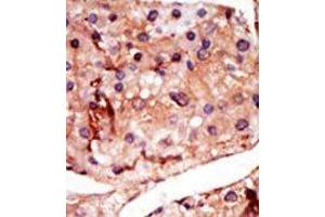 Image no. 1 for anti-6-phosphofructo-2-Kinase/fructose-2,6-Biphosphatase 2 (PFKFB2) (N-Term) antibody (ABIN360654) (PFKFB2 Antikörper  (N-Term))
