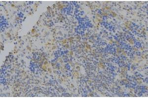 ABIN6276400 at 1/100 staining Human lymph node tissue by IHC-P. (ATG7 Antikörper  (N-Term))