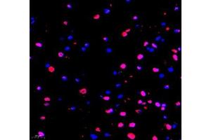 Immunofluorescence (Paraffin-embedded Sections) (IF (p)) image for anti-tRNA-YW Synthesizing Protein 1 Homolog B (S. Cerevisiae) (TYW1B) antibody (ABIN7076025)