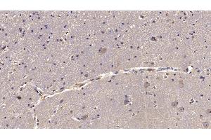 Detection of RELN in Human Cerebrum Tissue using Monoclonal Antibody to Reelin (RELN) (Reelin Antikörper  (AA 26-190))