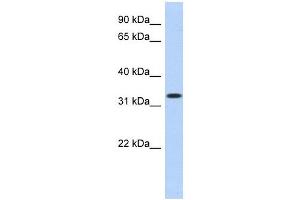 MPPED2 antibody used at 1 ug/ml to detect target protein. (MPPED2 Antikörper  (N-Term))