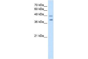 PSG1 antibody used at 2. (PSG1 Antikörper  (C-Term))