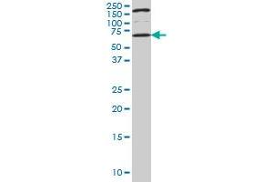 UCKL1 monoclonal antibody (M01), clone 8D4 Western Blot analysis of UCKL1 expression in NIH/3T3 . (UCKL1 Antikörper  (AA 301-400))