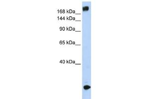 WB Suggested Anti-SCN5A Antibody Titration:  0. (SCN5A Antikörper  (N-Term))