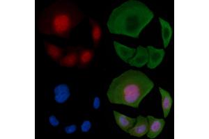 ABIN6255629 and ABIN6267394 staining Hela cells(30 min of UV treatment) by IF/ICC.