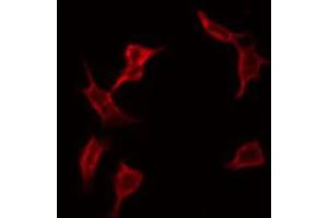 ABIN6266850 staining A549 by IF/ICC. (ADCK1 Antikörper  (Internal Region))