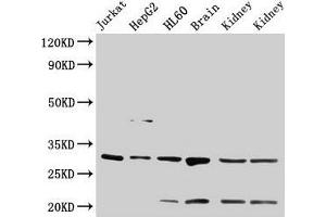 Western Blot Positive WB detected in: Jurkat whole cell lysate, HepG2 whole cell lysate, HL60 whole cell lysate, Rat brain tissue, Rat kidney tissue, Mouse kidney tissue All lanes: YWHAB antibody at 4 μg/mL Secondary Goat polyclonal to rabbit IgG at 1/50000 dilution Predicted band size: 29, 28 kDa Observed band size: 29 kDa (YWHAB Antikörper  (AA 1-246))