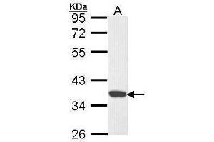 WB Image Sample (30 ug of whole cell lysate) A: Hela 10% SDS PAGE antibody diluted at 1:1000 (CDK6 Antikörper)