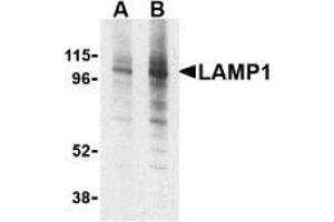 AP20059PU-N CD107a/LAMP1 antibody staining of EL4 cell lysate by Western Blotting at (A) 1 and (B) 2 μg/ml. (LAMP1 Antikörper)