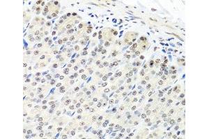 Immunohistochemistry of paraffin-embedded Mouse stomach using CNOT8 Polyclonal Antibody at dilution of 1:100 (40x lens). (CNOT8 Antikörper)