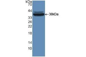 Detection of Recombinant MVP, Mouse using Polyclonal Antibody to Major Vault Protein (MVP) (MVP Antikörper  (AA 2-272))