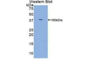Western Blotting (WB) image for anti-Mannose-Binding Lectin (Protein C) 2, Soluble (MBL2) (AA 42-96) antibody (ABIN3206582) (MBL2 Antikörper  (AA 42-96))