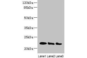 Western blot All lanes: ARL8B antibody at 4 μg/mL Lane 1: Mouse brain tissue Lane 2: NIH/3T3 whole cell lysate Lane 3: Jurkat whole cell lysate Secondary Goat polyclonal to rabbit IgG at 1/10000 dilution Predicted band size: 22, 19 kDa Observed band size: 22 kDa (ARL8B Antikörper  (AA 20-186))