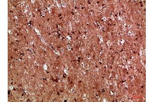 Immunohistochemical analysis of paraffin-embedded Human-brain, antibody was diluted at 1:100 (IL17D Antikörper  (AA 141-190))