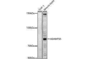Western blot analysis of extracts of various cell lines, using  antibody (ABIN3016805, ABIN3016806, ABIN3016807 and ABIN6219845) at 1:500 dilution. (ADAMTS5 Antikörper  (AA 731-930))