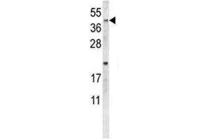 Western blot analysis of NEU1 antibody and MDA-MB231 lysate. (NEU1 Antikörper  (AA 11-40))