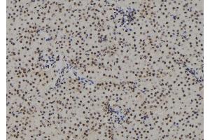 ABIN6267162 at 1/100 staining Mouse kidney tissue by IHC-P. (Progesterone Receptor Antikörper  (pSer190))