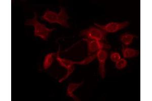 Immunofluorescence (fixed cells) (IF/ICC) image for anti-VEGF Receptor 2 (VEGFR2) (pTyr951) antibody (ABIN6256071)